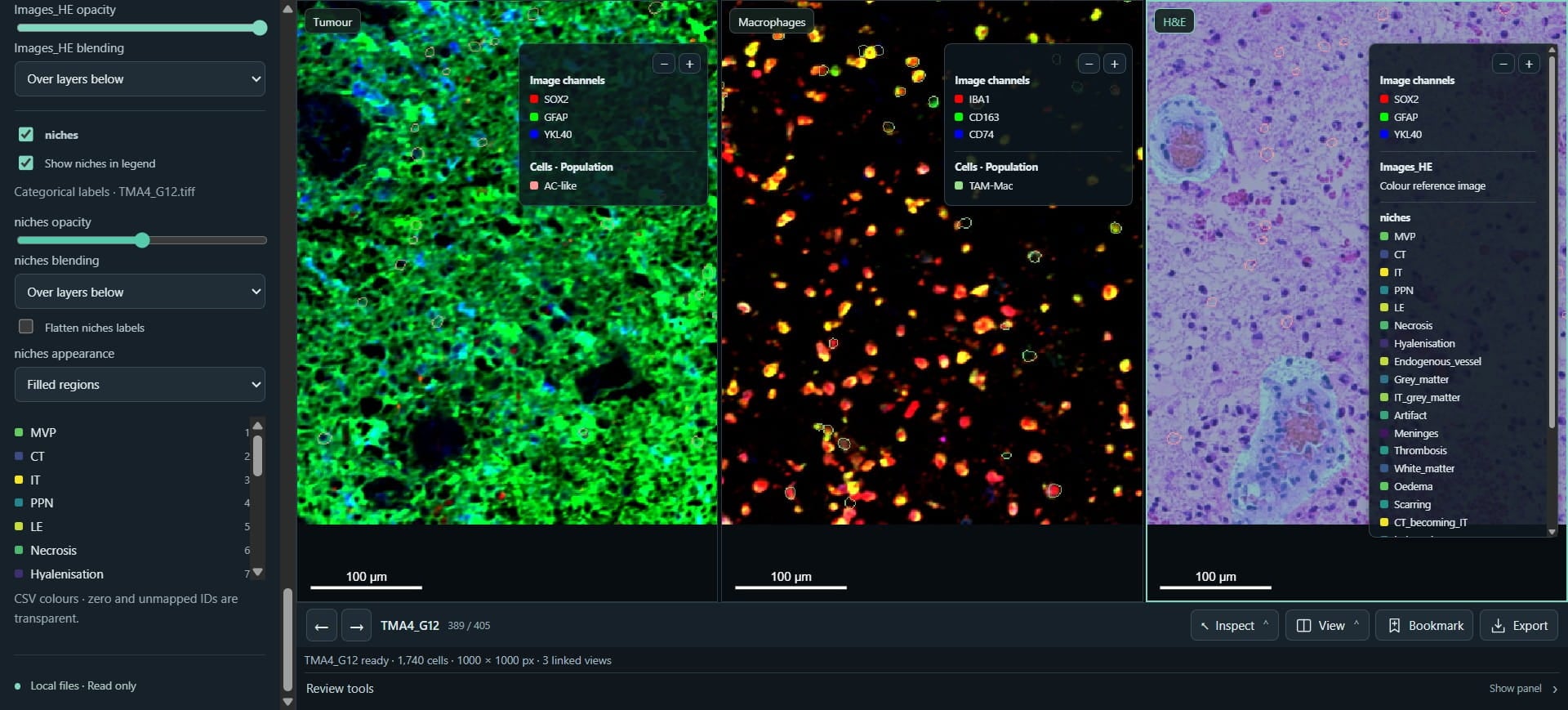 We can customise the extra layers, e.g. opacity
