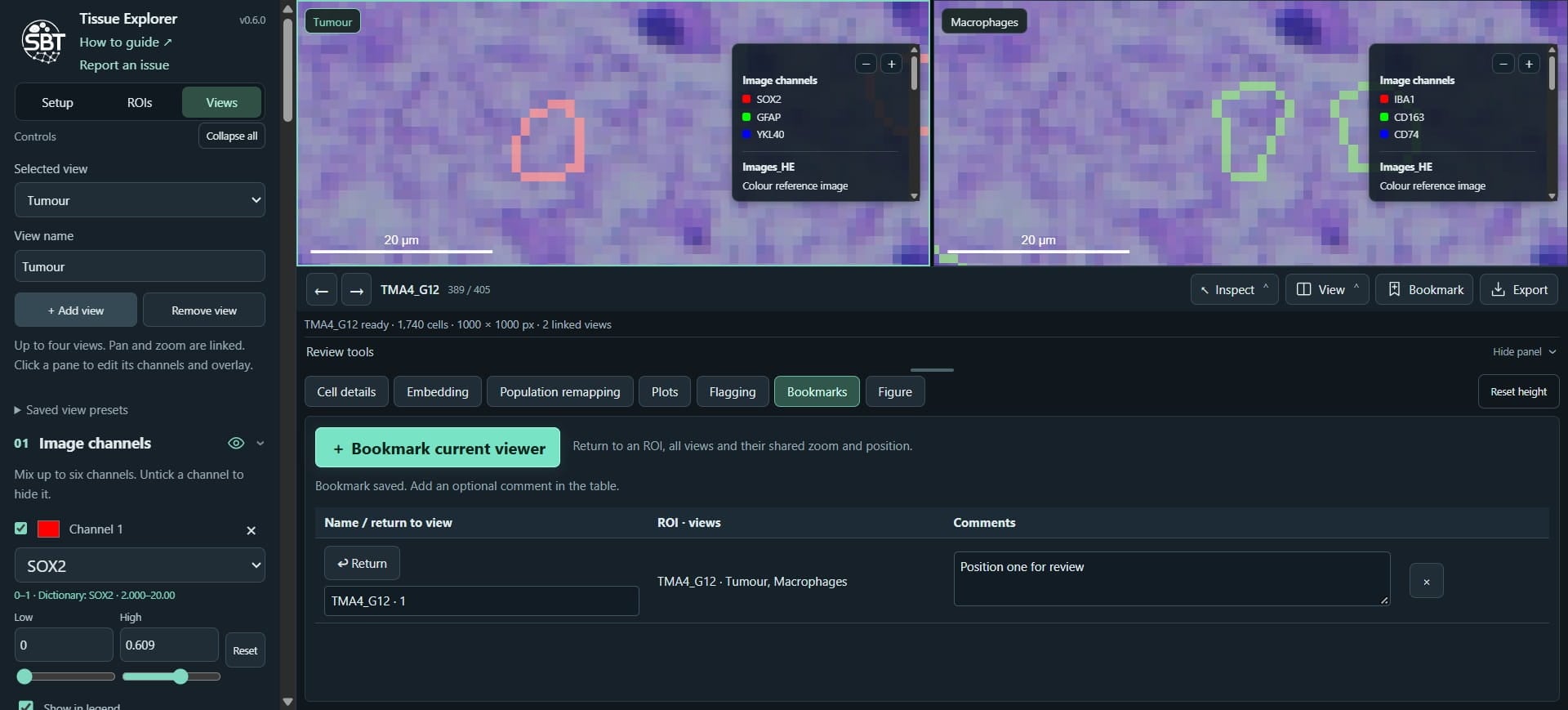 Click on "+ Add view", we will setup a new dedicated view for the H&E