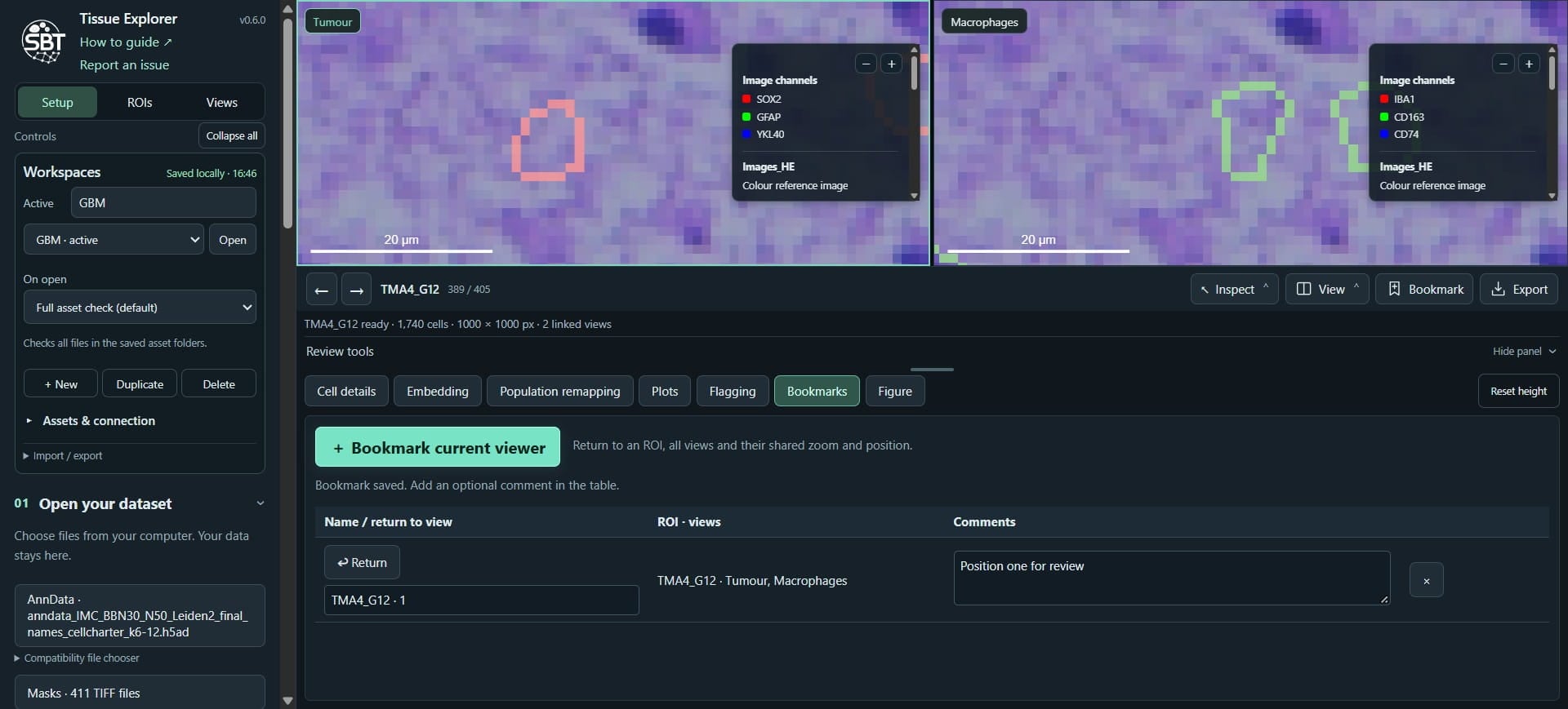 Click on "Views" - we can customise where the H&E images are shown in each view