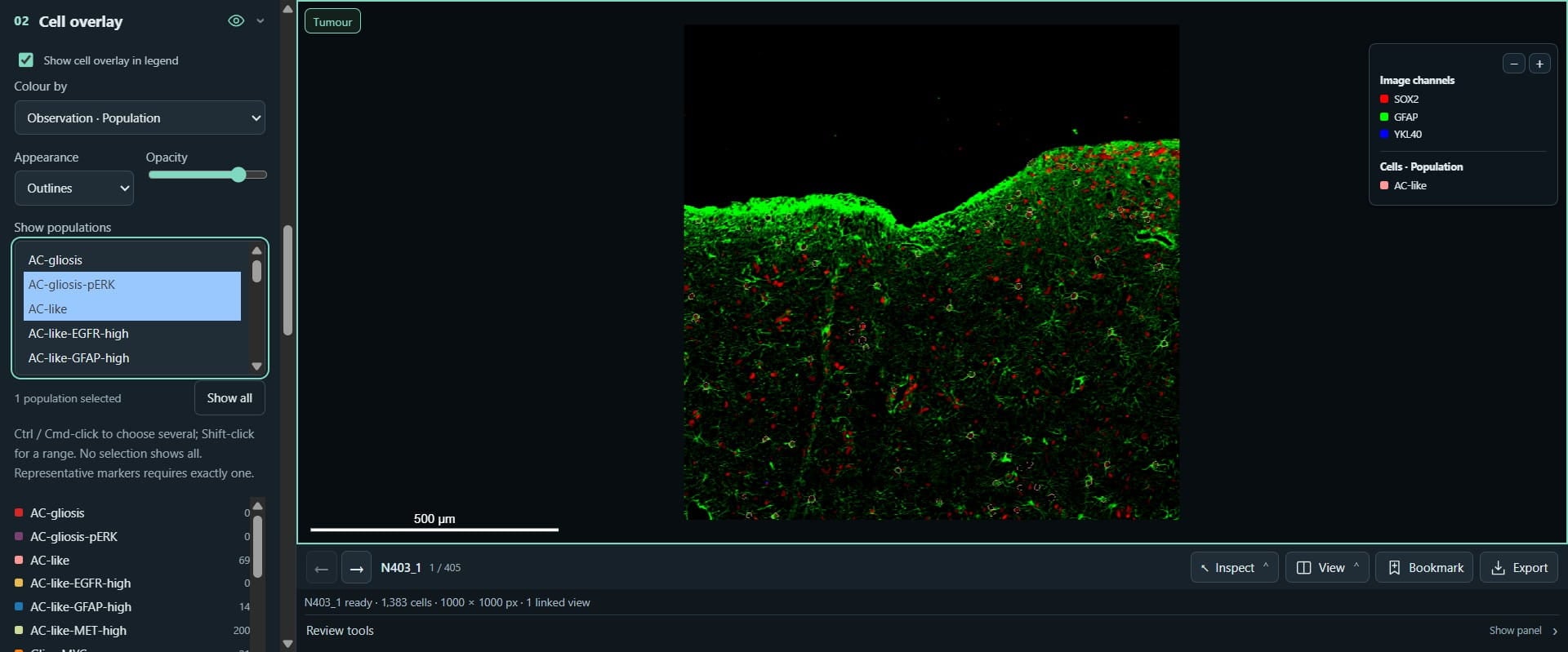 Click on "AC-gliosis-pERK"