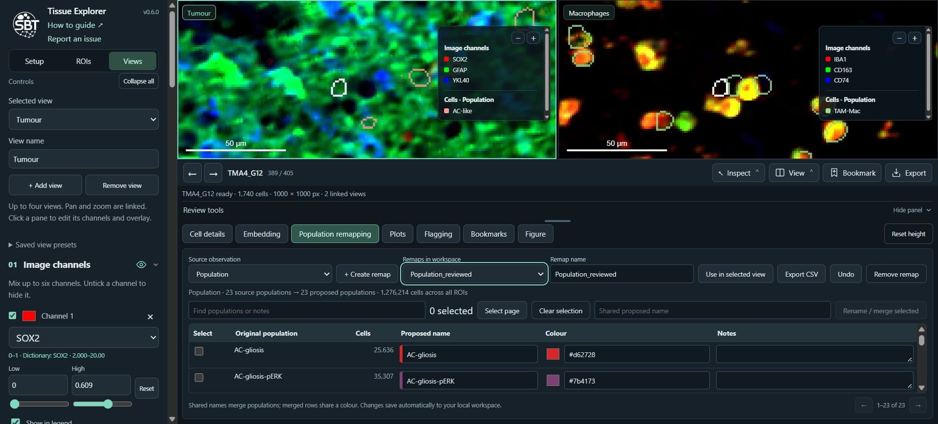 Click on "Population_reviewed"