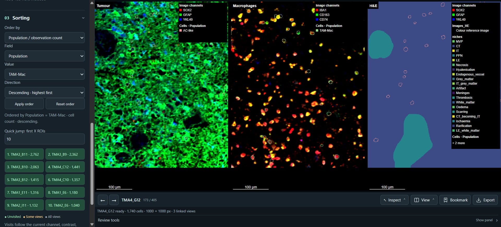 Click on "1. TMA3_B11 · 2,762" - this is the population with most TAM-Mac cells.